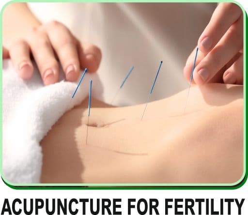Image representing acupuncture for infertility.
