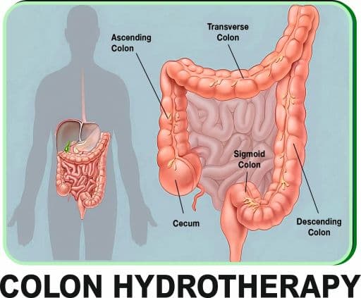 Image representing colon hydrotherapy.